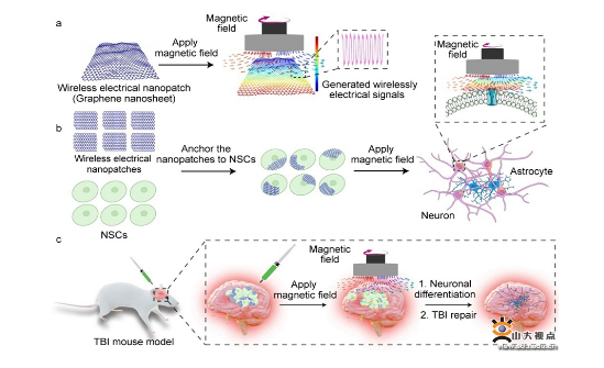 刘宏、仇吉川教授团队医工交叉新进展：无线电刺激细胞贴片促进创伤性脑损伤修复